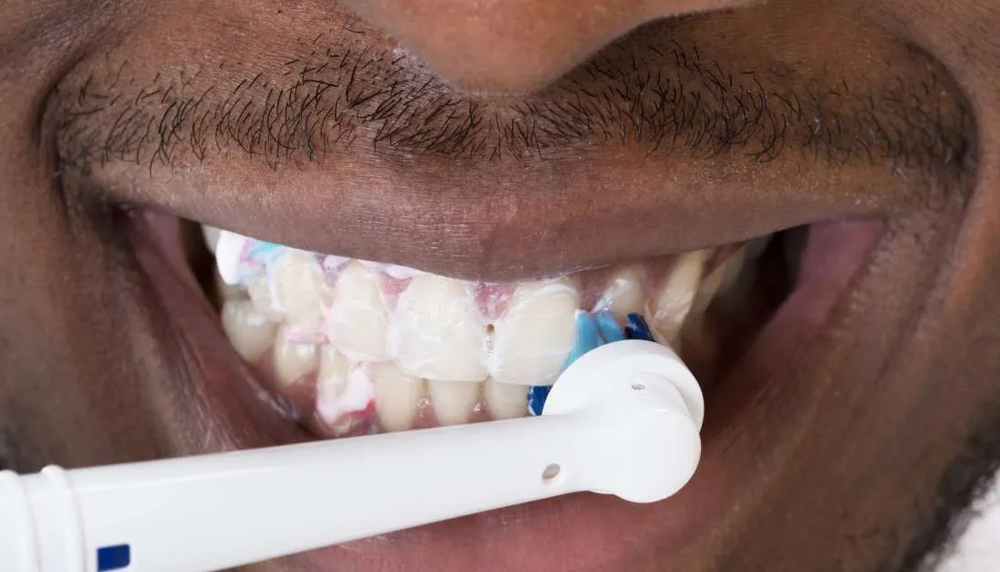 31722 teeth whitening deutsch grundlagen