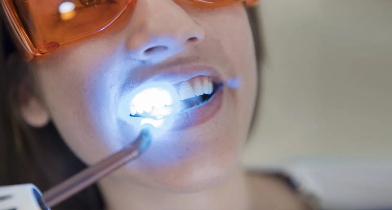 31722 teeth whitening ursachen