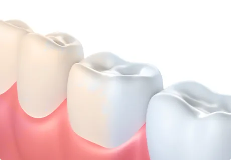 31723 teeth whitening baltimore md 2