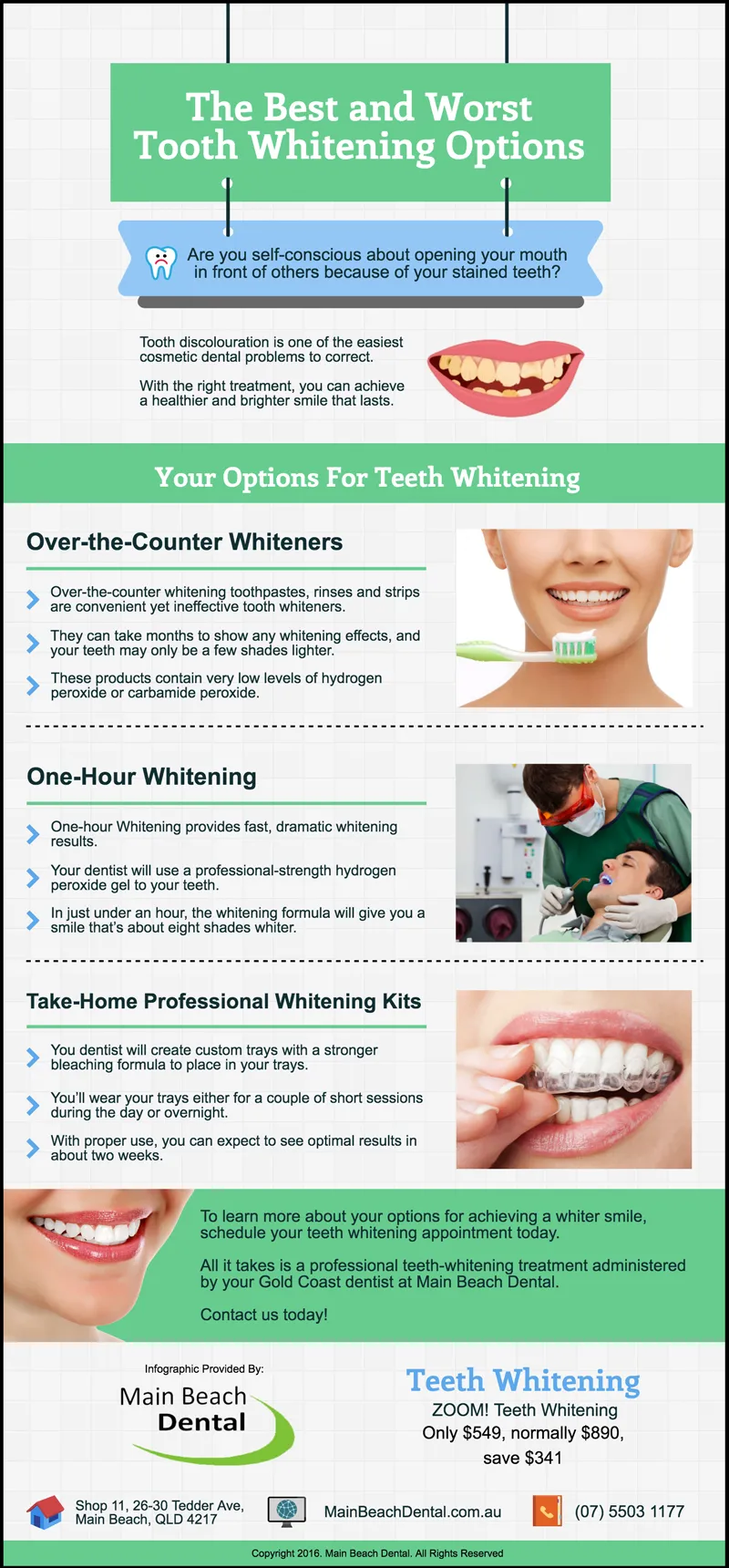 31725 professional teeth whitening