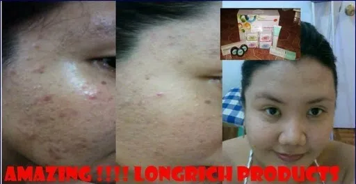 31726 how to use longrich
