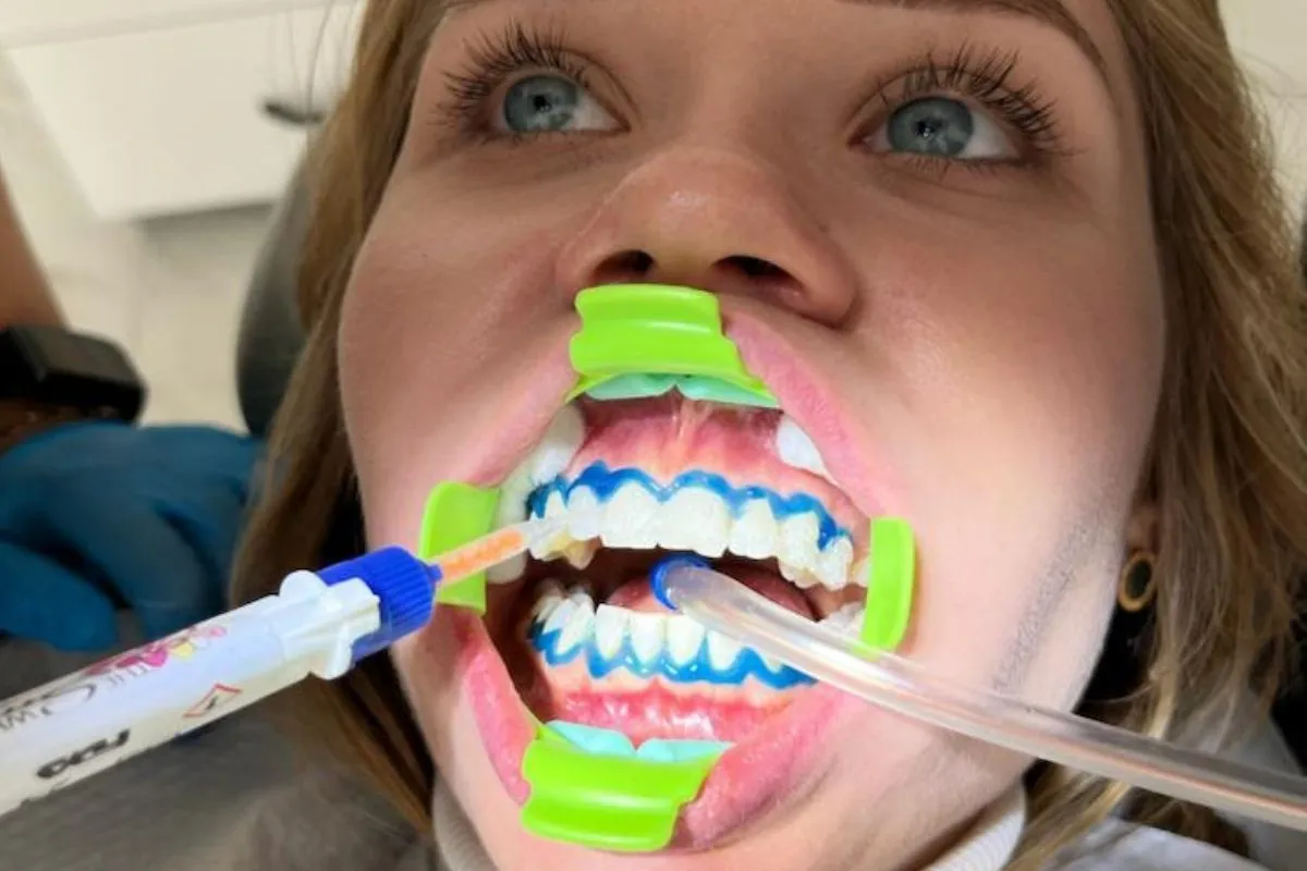 /img/31733-dental-checkups.webp