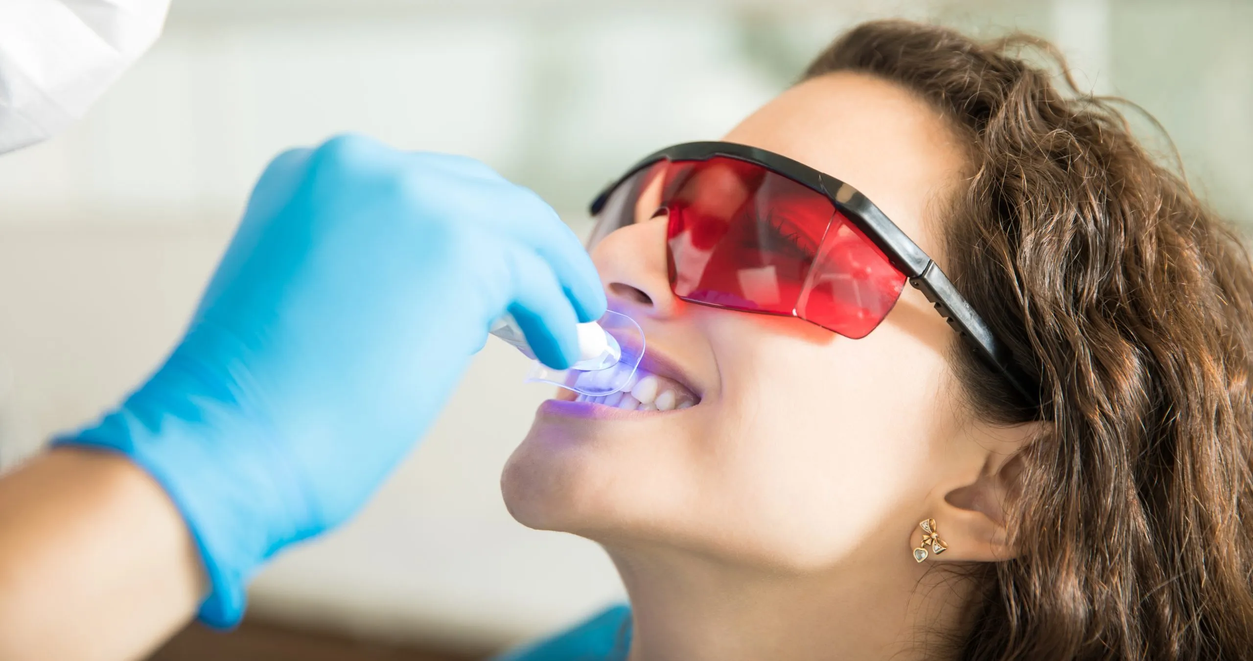 31733 professional teeth whitening