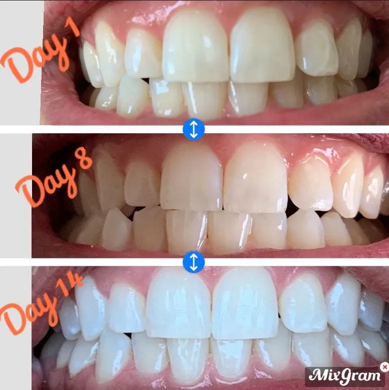 31737 whitening toothpaste overview