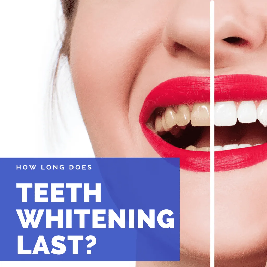 31749 white smile maintenance