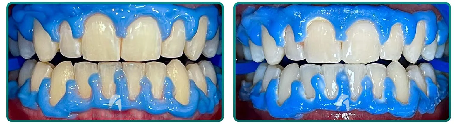 31756 maintaining good oral hygiene