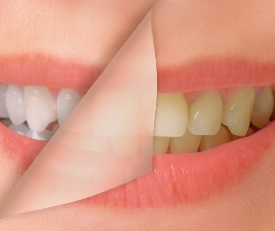 31760 sensitive teeth toothpaste