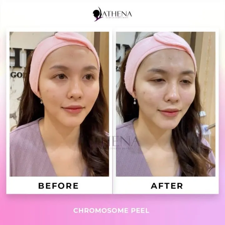 31762 pre treatment tips