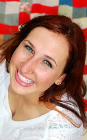 31766 professional teeth whitening olympia