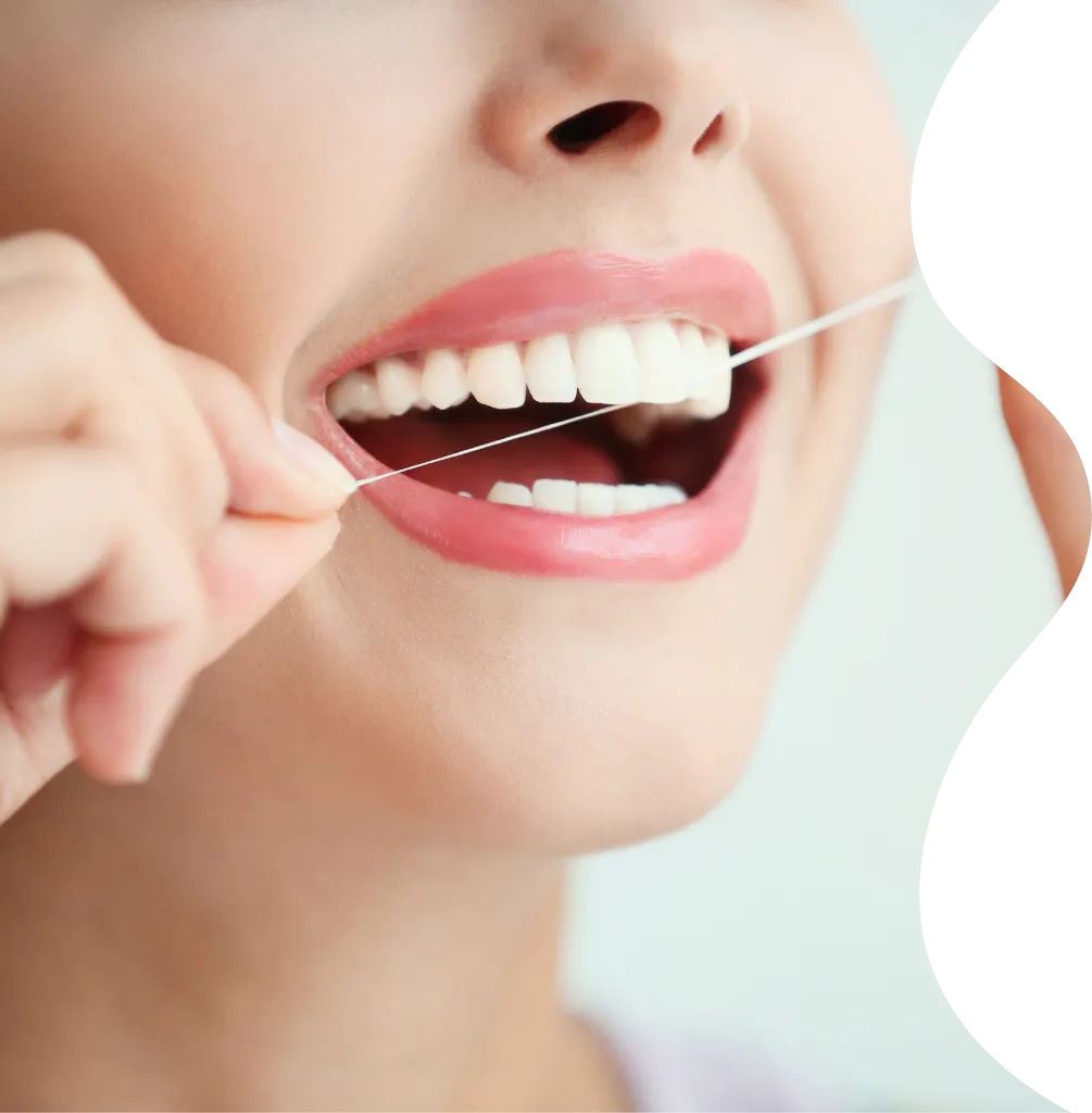 31766 take home teeth whitening kit