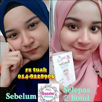 31771 shhaz booster whitening customer review