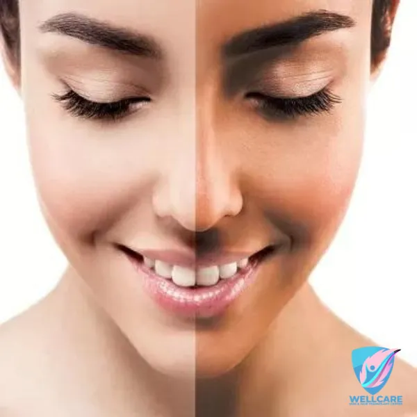 31771 shhaz booster whitening product