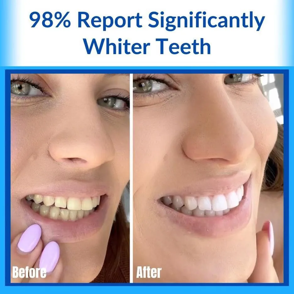 /img/31772-teeth-whitening-columbia-md-image7.webp