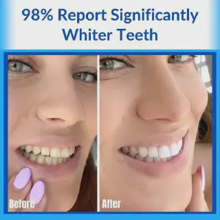 /img/31772-teeth-whitening-columbia-md-image7.webp