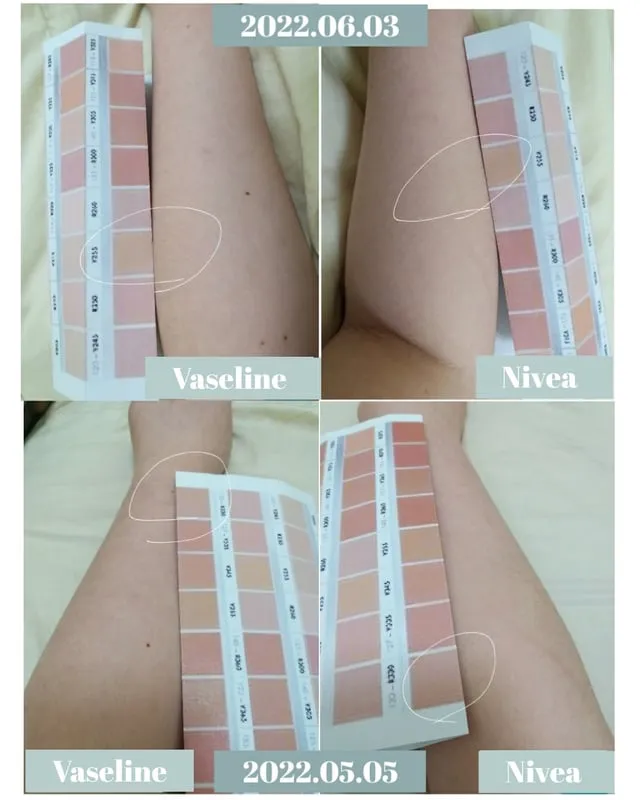 31773 healthy skin diet