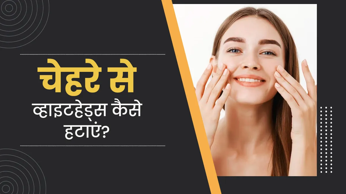 31776 hyperpigmentation