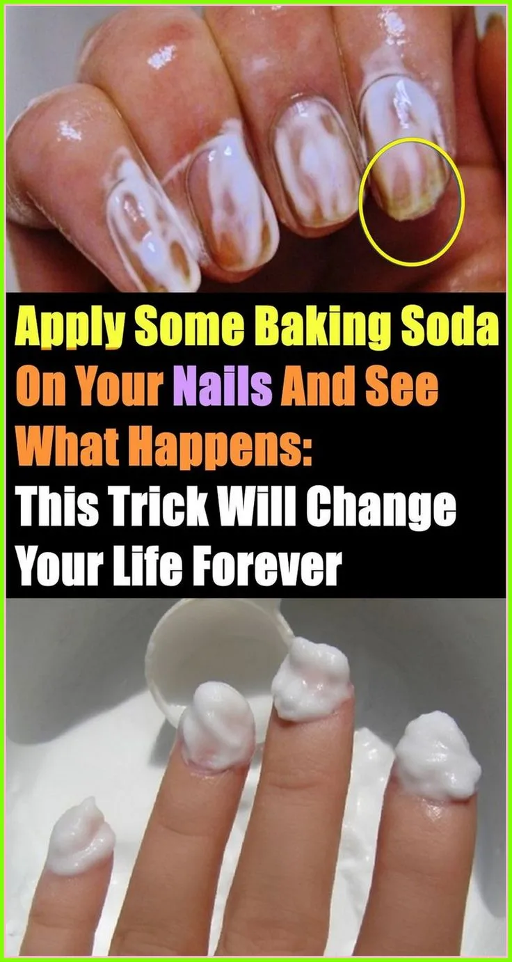 31784 nail discoloration