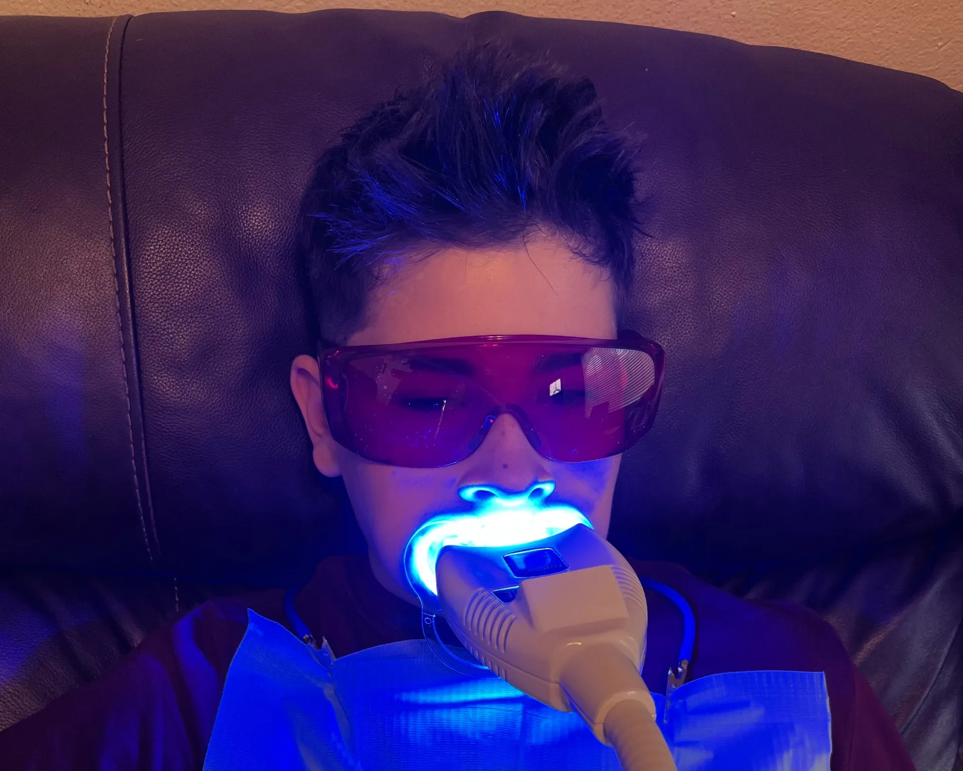 31792 at home teeth whitening
