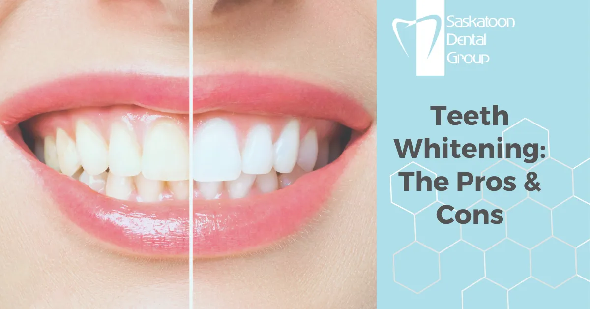 31799 teeth whitening fillings crowns