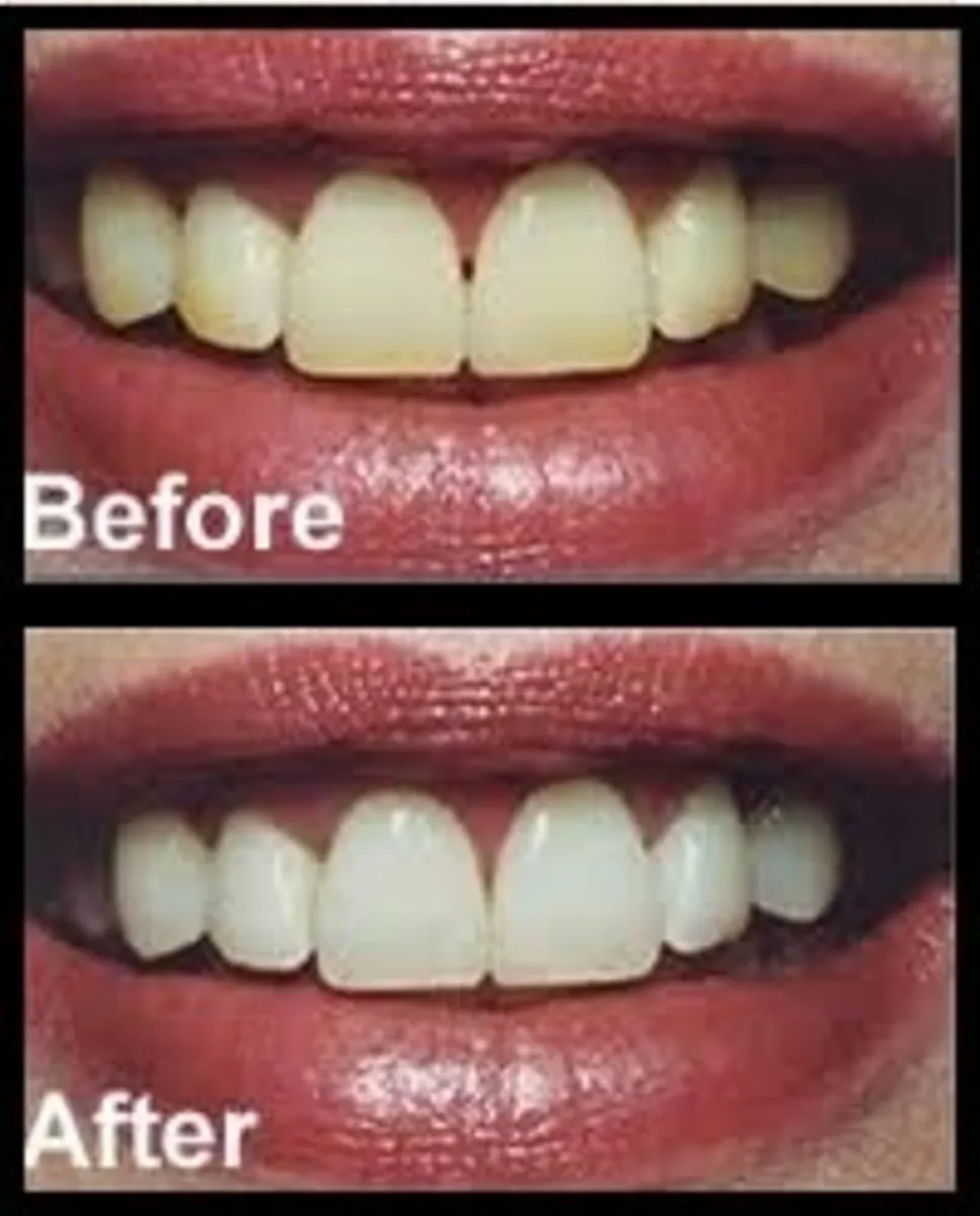 31807 baking soda teeth