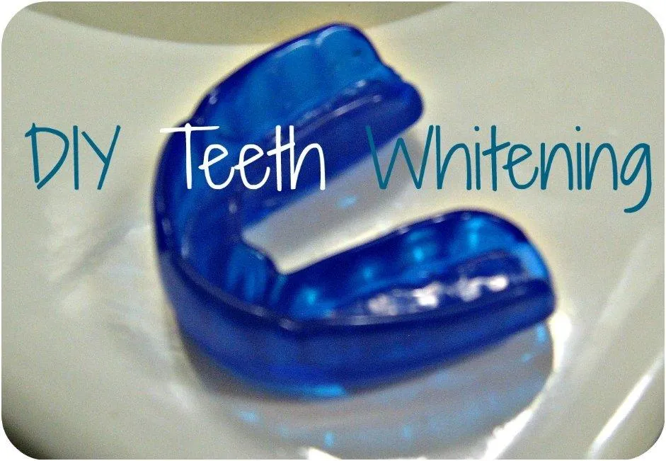 31807 before after teeth whitening