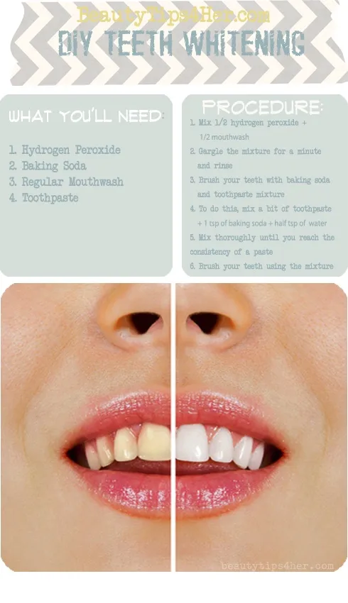 /img/31807-hydrogen-peroxide-teeth.webp