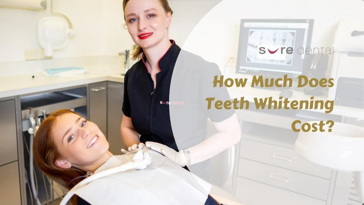 31810 at home teeth whitening kits